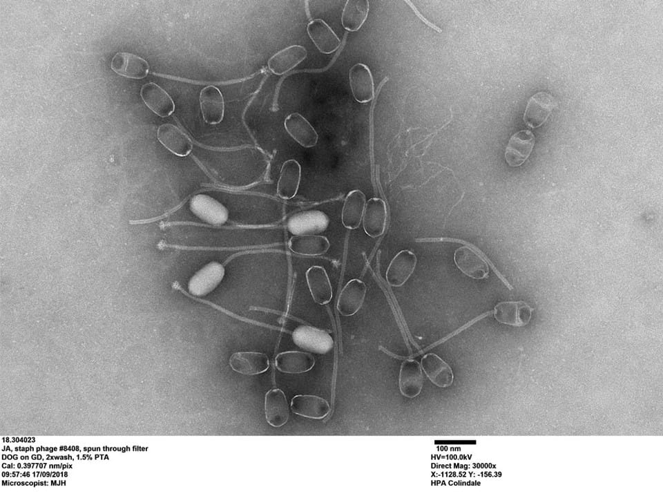 phage TEM